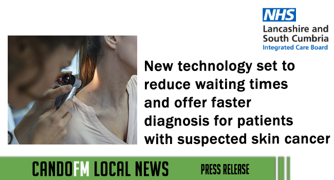 New technology set to reduce waiting times and offer faster diagnosis for patients with suspected skin cancer